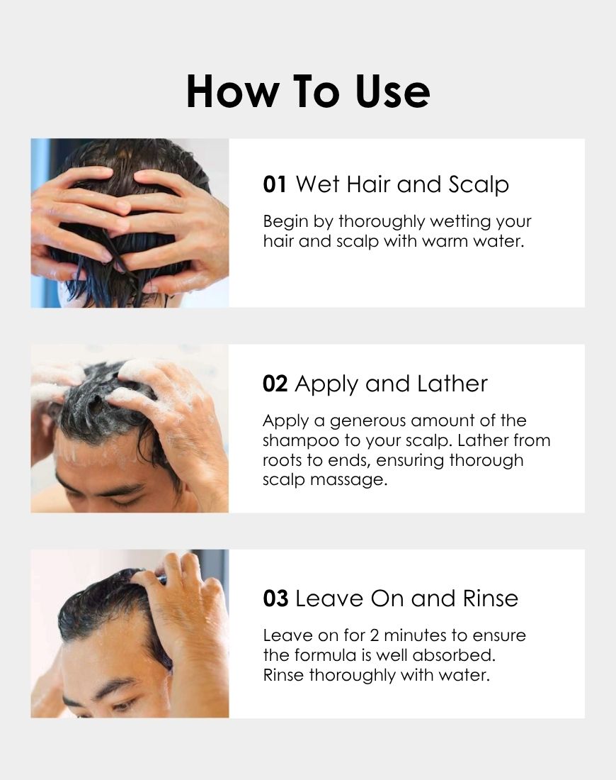Apestomen Anti-Dandruff Treatment Shampoo 350ml With Piroctone Olamine | Clinically Proven To Control Dry Flaking, Scaling & Itching From Oily Dandruff | pH 4.5-5.5 | Paraben, Sulfate & Silicon free