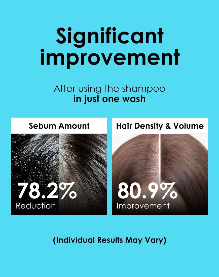 Apestomen Oil Control + Volume Boost Shampoo 350ml With Saw Palmetto | Block DHT Balance Hormone Levels Combat Hair Loss