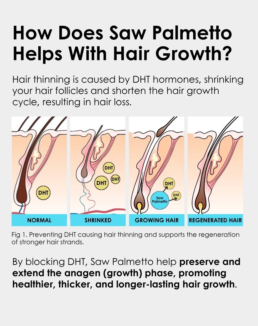 Apestomen Oil Control + Volume Boost Shampoo 350ml With Saw Palmetto | Block DHT Balance Hormone Levels Combat Hair Loss