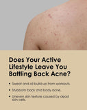 Apestomen Exfoliating & Anti-Acne Body Wash 350ml With Salicylic Acid | Treat Back Acne & Improve Overall Skin Appearance